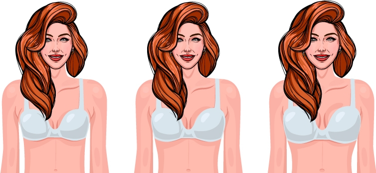 Breast Size